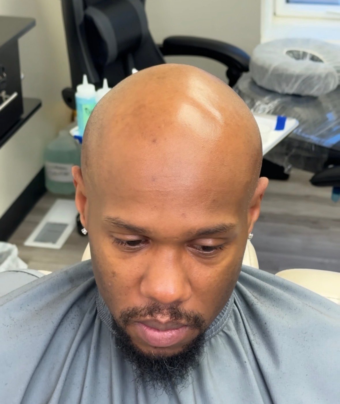 Client 2 before